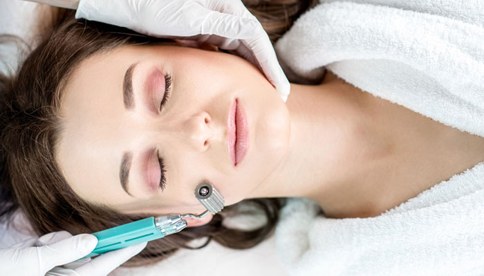 Microneedling
